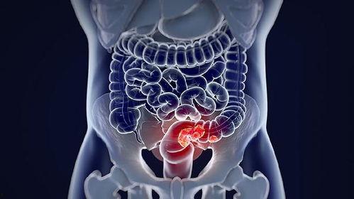 成人肠虫清吃几次视频,高效驱虫，一次见效，轻松告别肠道寄生虫困扰